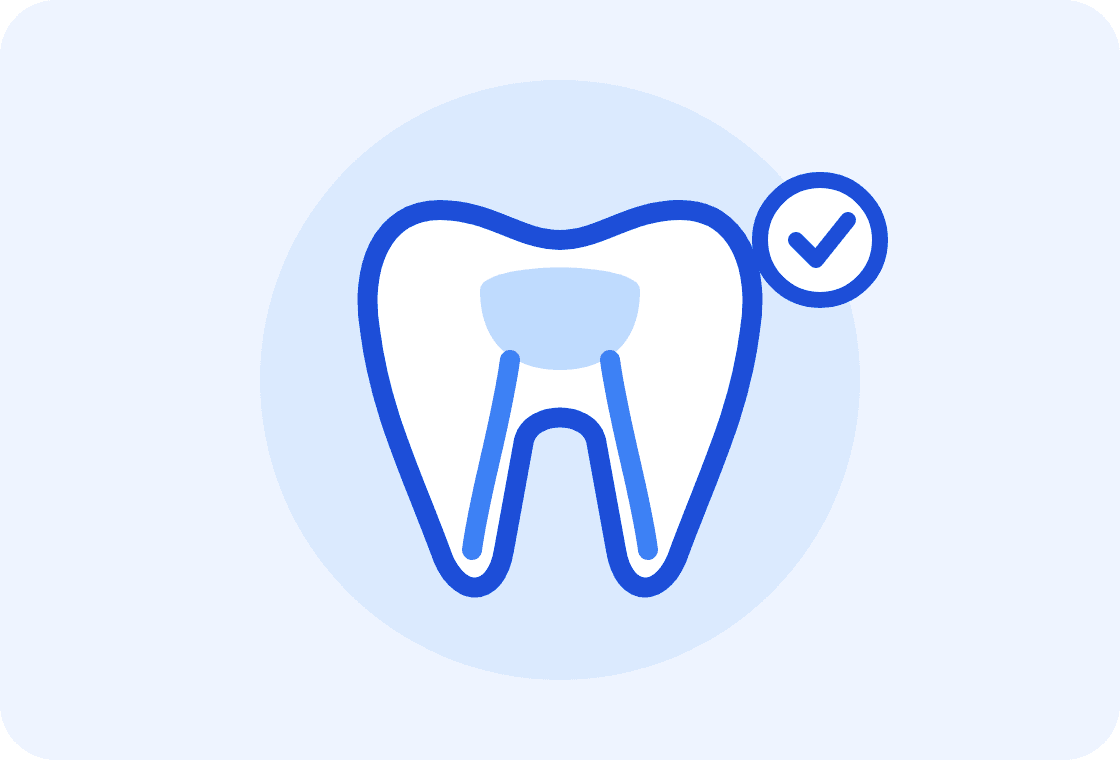 Illustration of a tooth's root canals